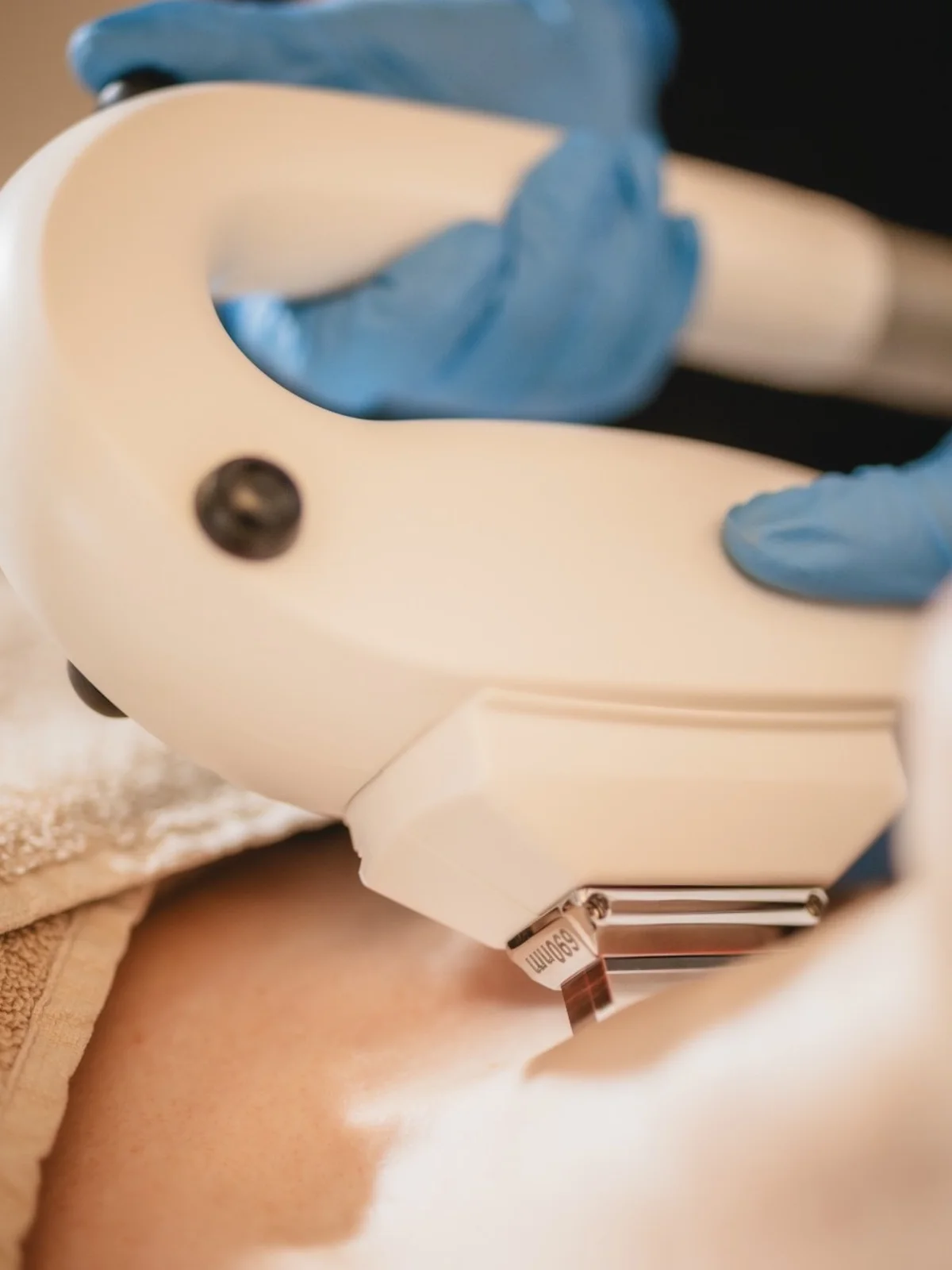 Lichttherapie met IPL bij LIV Derma Institute